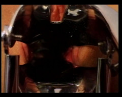 Speculum in a hippie | Download from Files Monster