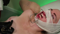Vivienne Lamour - Medical Intervention - Sadistic Nurse Staples | Download from Files Monster